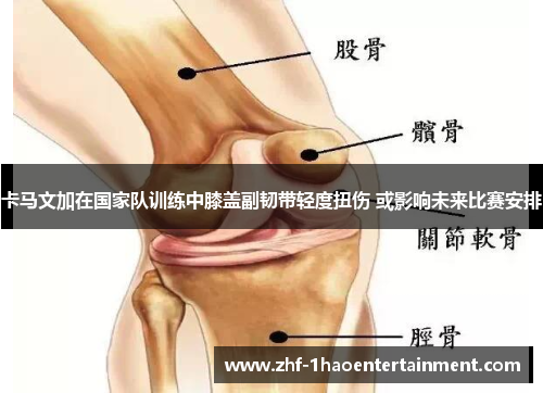 卡马文加在国家队训练中膝盖副韧带轻度扭伤 或影响未来比赛安排 卡马文加在国家队训练中膝盖副韧带轻度扭伤 或影响未来比赛安排